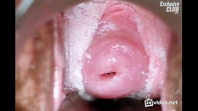 Exame ginecológico de uma bela mulher